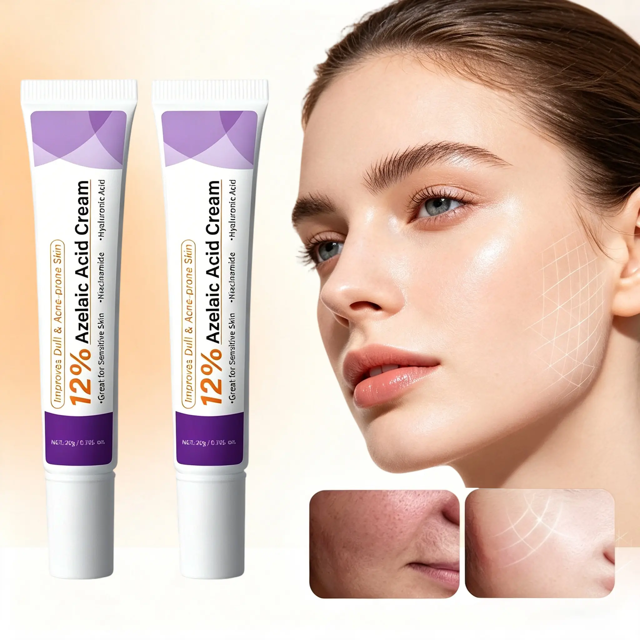 12% Azelaic Acid Face Moisturizer, Gentle Acne Clearing Cream for Sensitive Skin, Hydrating Dark Spot & Blemish Fader, Set of 2 (1.05 oz), Acne Clearing Products
