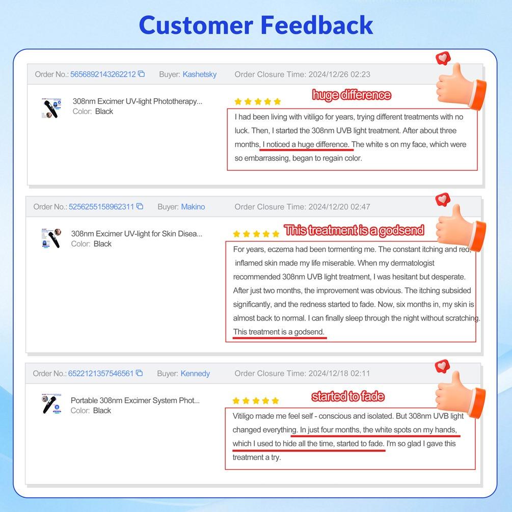 ZJZK 9 Diodes 308nm UVB Excimer Phototherapy Device, 65mW/cm² High Energy Density, Handheld Blue Light Skin Treatment, Targeted Therapy for Vitiligo, Psoriasis, Eczema, Atopic Dermatitis, Portable Home Use for Skin Disorders