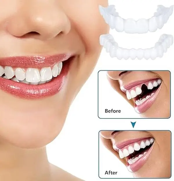 Instant Clip On Veneers Temporary Tooth Cover, Cosmetic Snap On False Teeth for Missing Stained Cracked Teeth