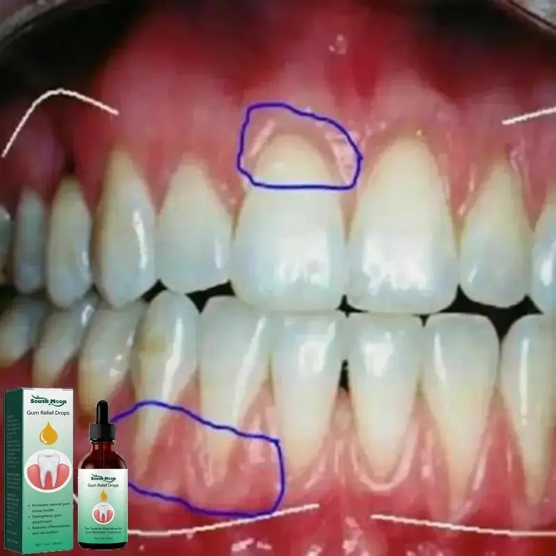 30ml Oral Care Drops - Rapid Cavity Repair, Gum Care, Teeth Cleansing, Caries Relief, Toothache Alleviation, Plaque & Stain Removal, Mousse with Storage Function