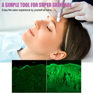 2025 New Multi-Function Microdermabrasion Pen with 5 x 0.25mm Replacement Tips, Light Beige Care Tool