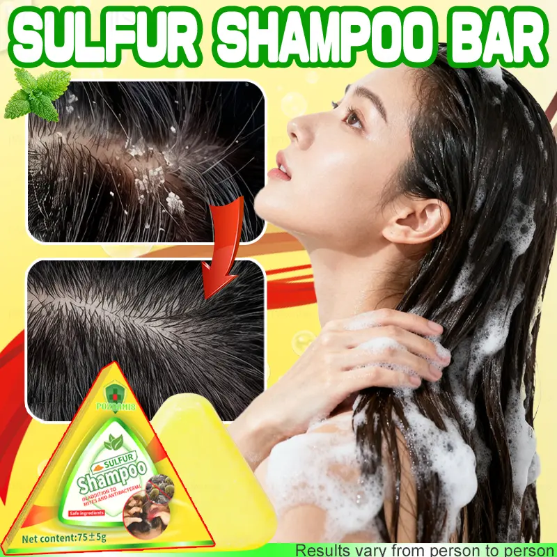 POZOAMIS Sulfur Shampoo Bar for Dandruff & Itchy Scalp Relief, Antibacterial Herbal Cleanser for Oil Control, Foaming Scalp Care for Straight, Wavy & Textured Hair, 75g, Soap, Dandruff Treatment, Anti-Dandruff