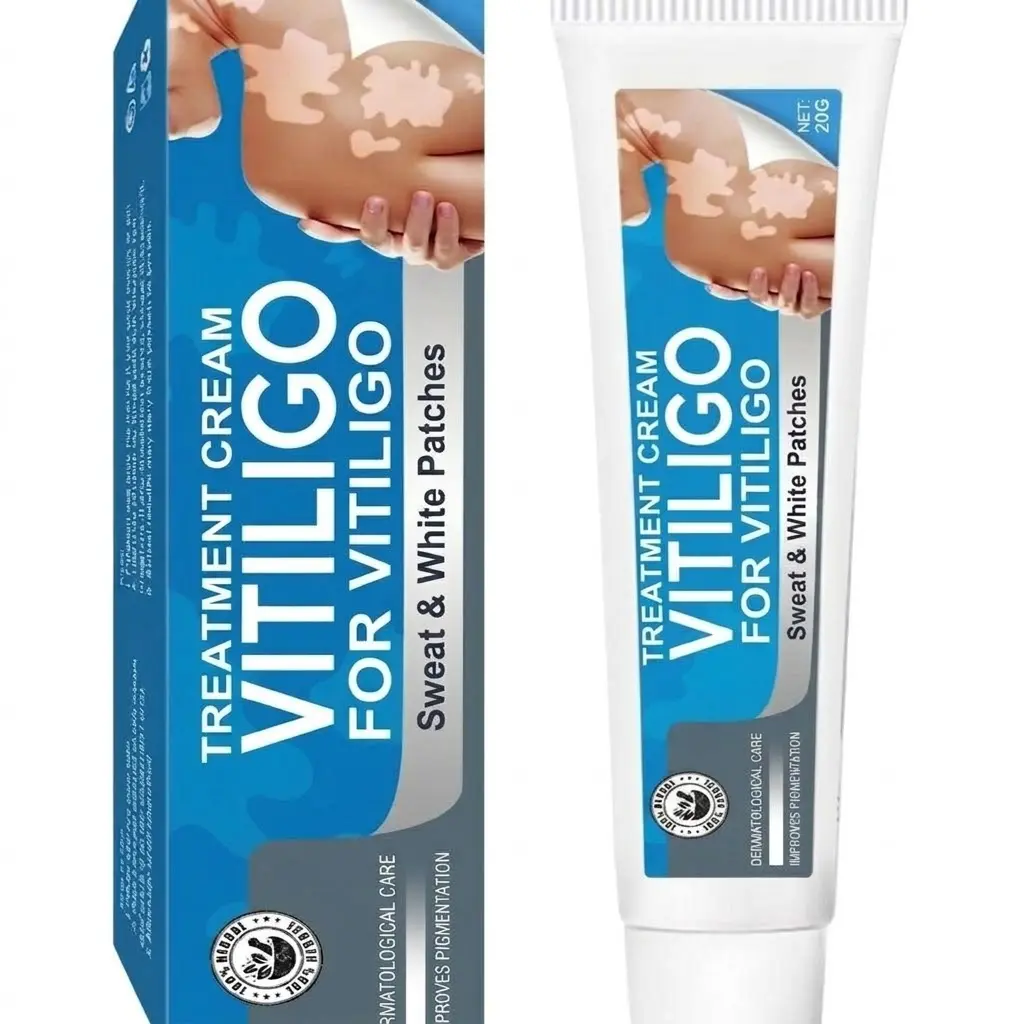 Vitiligo Cream, Natural Effective Vitiligo Treatment for Reduce White Spots and Improve Skin Pigmentation