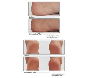 KAPLAN MD Diamond Contour Gommage Exfoliating Body Peel Spray