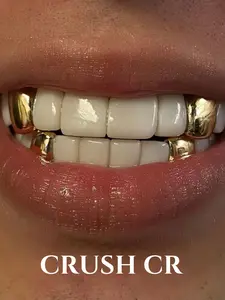 CRUSH CR 14K Gold Plated Solid Single Tooth Cap Set for Men Women, Unisex, Hypoallergenic Removable, for Hip Hop Concerts, Streetwear Fits, Club Nights, Durable Tarnish-Resistant Plating, Subtle Bling Oral Dental Jewelry, Golden Color
