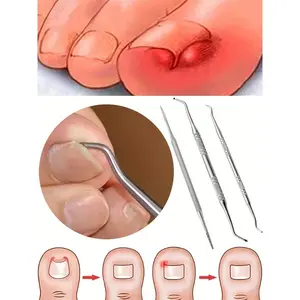 3 Pcs Silver Color Ingrown Toenail Removal Kit, Stainless Steel Nail File & Toe Lifter, Professional Pedicure Tools for Toenail Care, Toenail Treatment