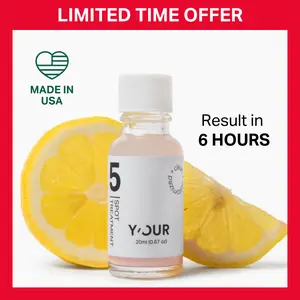 Acne Drying Spot Treatment by Y'OUR, with Salicylic Acid & Bentonite Clay for Sensitive Skin 20ml Fast Acting Potent Pimple Remover, Made in USA. Valentine gift for her
