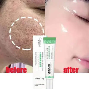 Salicylic Acid Pore Shrinking Cream Tighten Face Smooth Skin Moisturizing Korean Care Product Ladies Cosmetics 2024 NEW