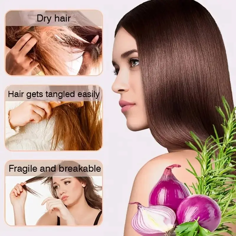 Onion Oil Hair Serum for Smooth and Shiny Hair, Suitable for Normal Hair Type, 30g Liquid Form, Non-Toxic, Promotes Healthy Hair Growth