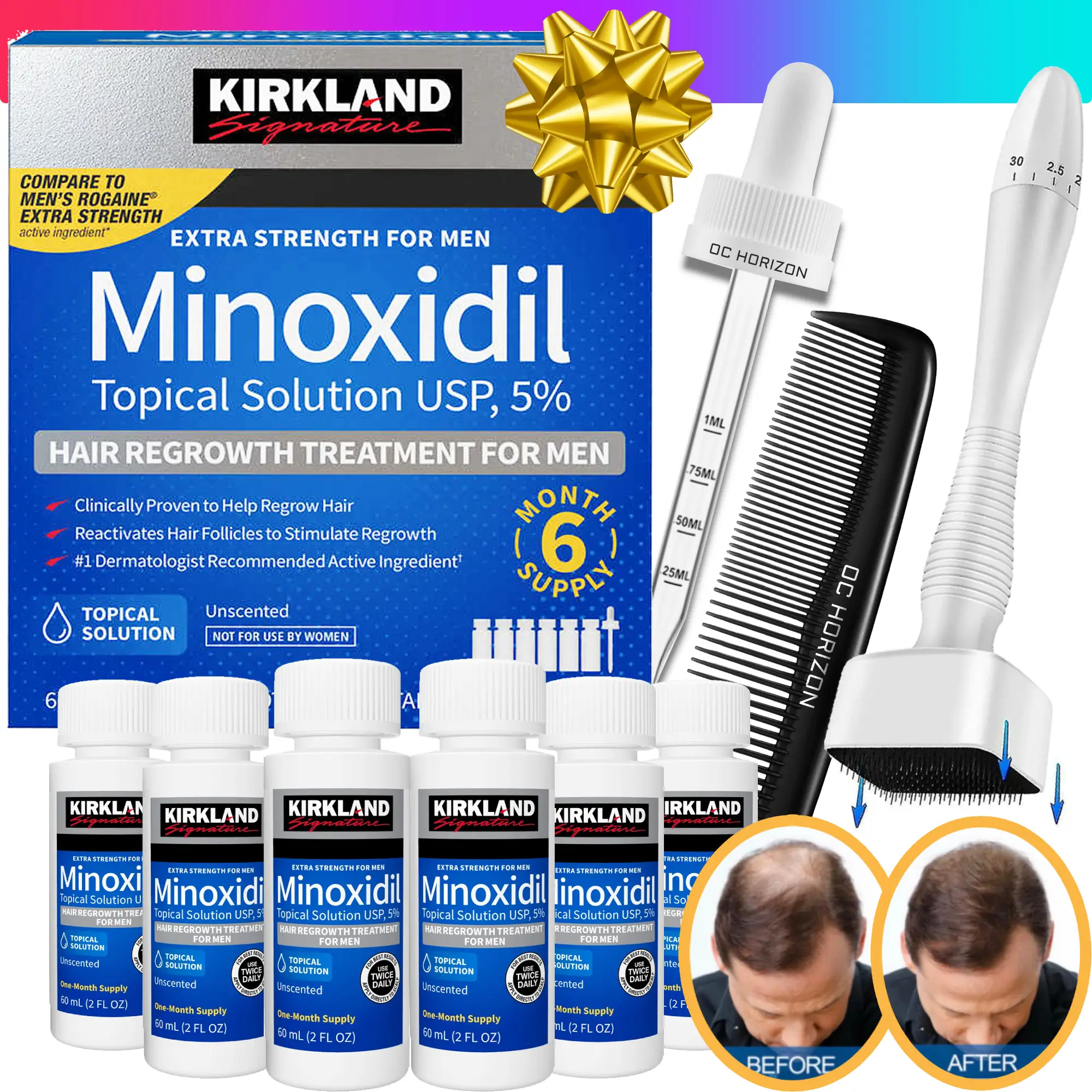 KIRKLAND Signature Minoxidil 5% Hair Loss Treatment Multi-Pack Includes Comb & Dropper (Optional DermaStamp) Hair & Beard Regrowth Solutions Comfort E
