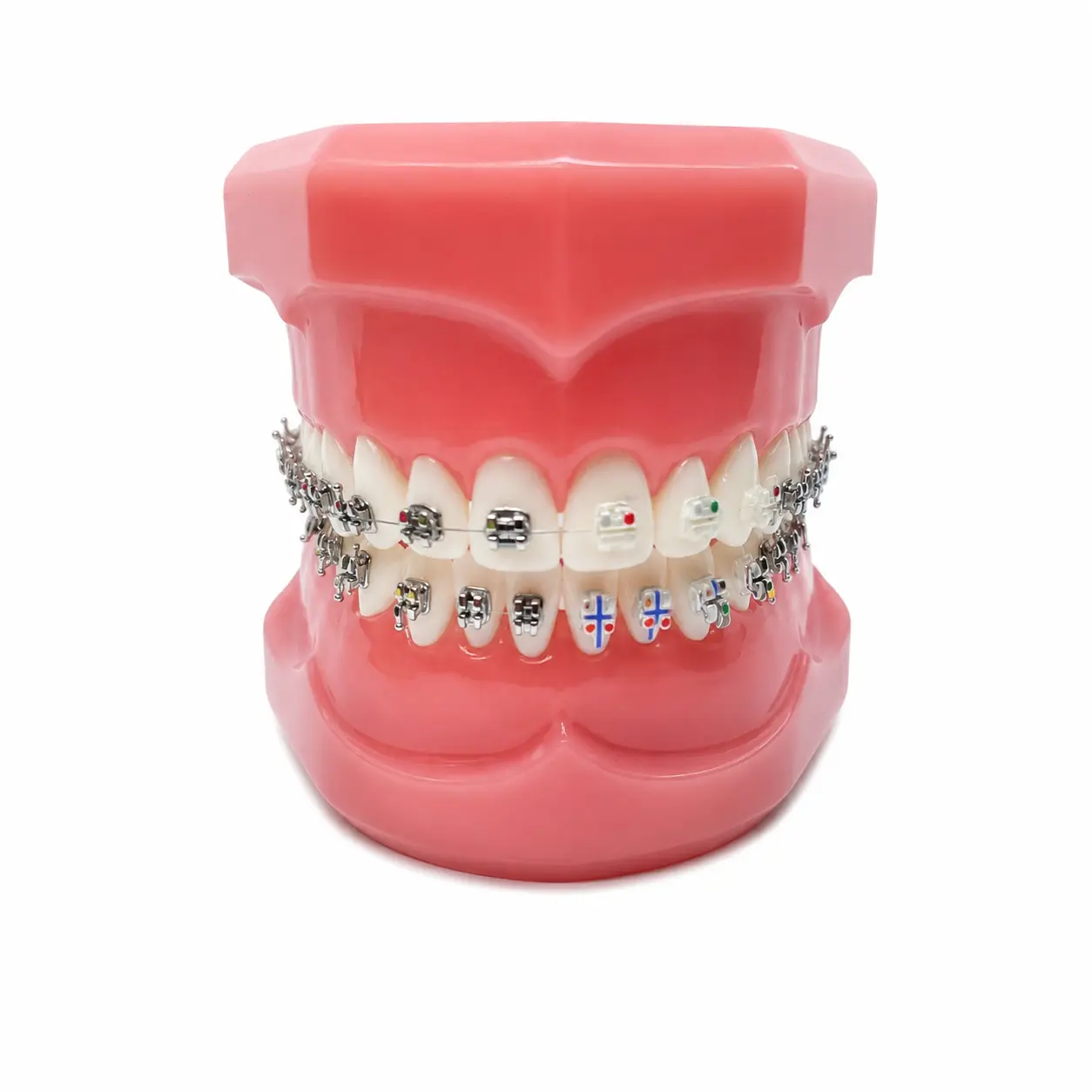 Model for Study with self ligating Brackets 7×7 EasyClip+ Passive 022 MBT Hk 3,4,5 w/28 pcs Vector+, BioMax, Ceramic Translux, Sapphire Aditek 00.02.0005