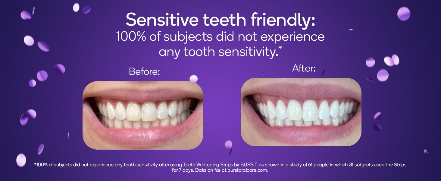 BURST Teeth Whitening Strips for Sensitive Teeth, No-Slip Grip, Dental White Strips Kit, 20 Strips, 10 Treatments, Visibly Whiter Teeth After One Use