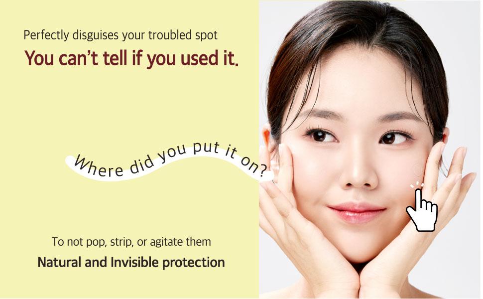 [mixsoon Official Shop] Spot Cleancare Patch (84 Patches) - Pimple Seamless Patches to Cover and heal Troubled Spots