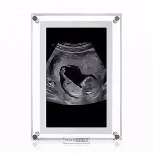 SnapFrame Digital Frame - 5 Inch Sleek Design for Ultrasound Photos & Pregnancy Milestones - Perfect Gift for Expecting Couples - 3700 Happy Customers
