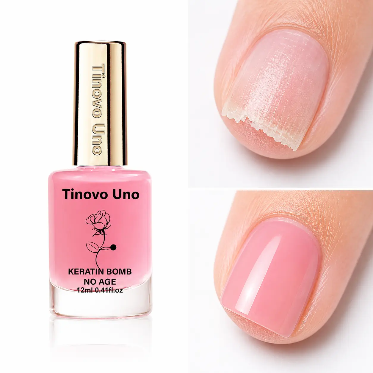 Tinovo Uno Nail Strengthener Keratin Bomb 12ml 0.41oz Specially Formulated for Brittle Nails and Nail Care Effectively Repairing Fragile Nails