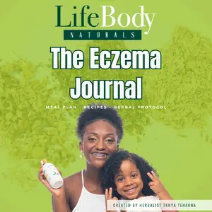 The Eczema Journal