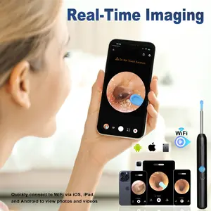 Spring Visual Ear Wax Removal Kit - 9pcs Set: HD Wireless Otoscope with WaterproSpring Visual Ear Wax Removal Kit - 9pcs Set: HD Wireless Otoscope with Waterproof Ear Camera, Safe & Easy Earwax Cleaner Compatible with iOS & Android Phones/Tablets