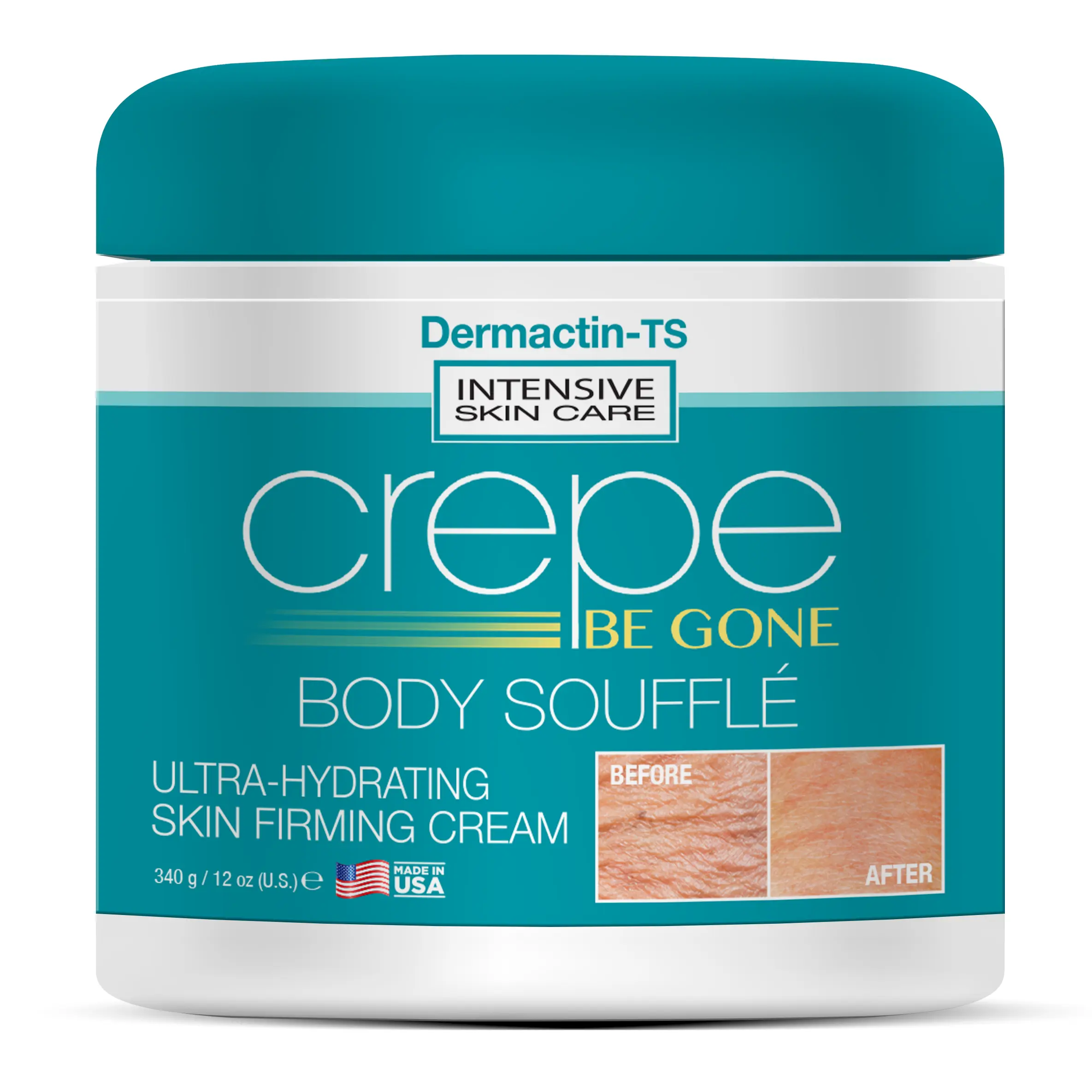 Crepe Be Gone Classic Body Soufflé - New Larger 12 ounce Hydrating Moisturizing Body Care Cream
