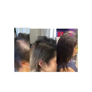 Awakening Dead Hair Follicles Hair Growth Shampoo - Gentle & Effective Haircare