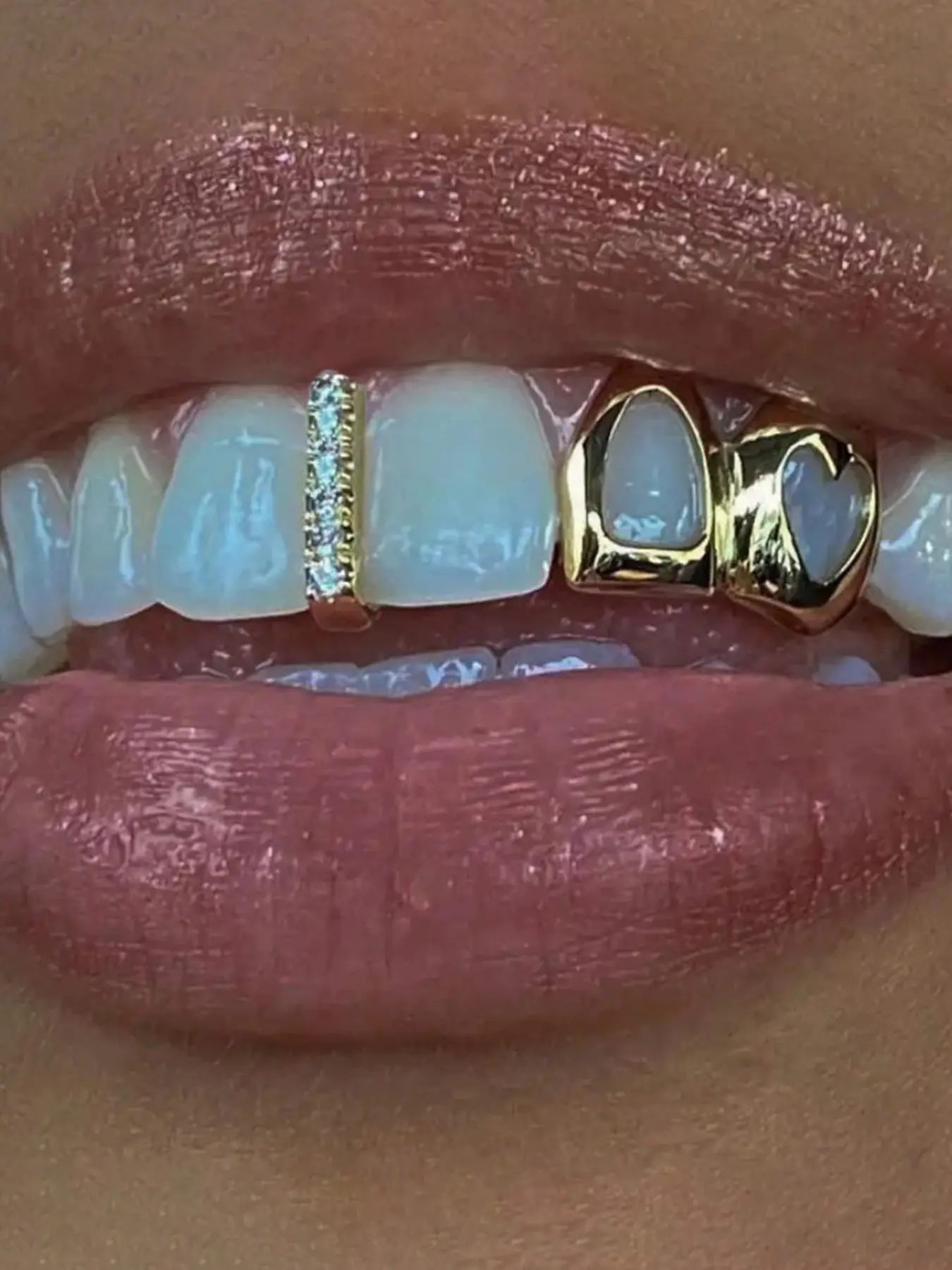 Street Style Double Heart-shaped Hollowed-out Zircon Braces & Single Vertical Zircon Braces, Hip-hop Braces Set, Rapper, Teeth Brace, Teeth Accessory