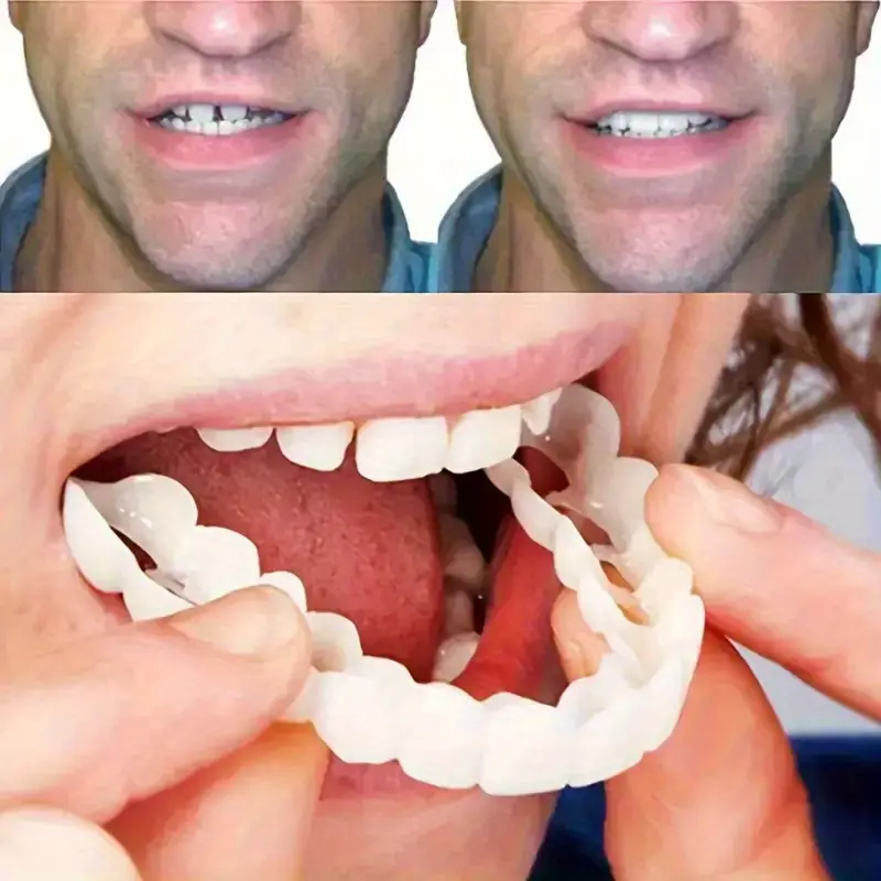 Sporty Chic Plaid Grillz, 4-Piece Plastic Fake Teeth Set for Adults, Adjustable Cosmetic Brightener for Cosplay with Case, Teeth Whitener