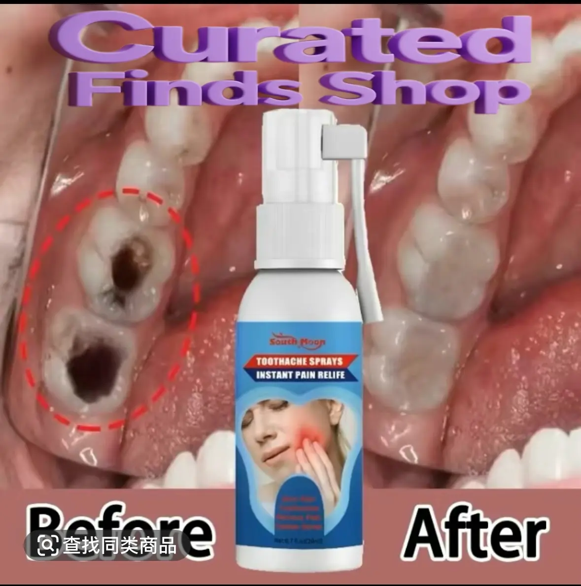 South Moon Toothache Relief Spray: Quick Relief for Toothaches,Cavities, Gum Swelling, and Oral Discomfort