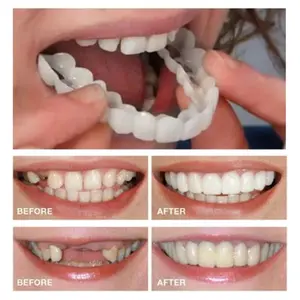 White Denture Belt Veneer-Unisex Upper and Lower Denture Care-Flexible and Comfortable, Realistic, Dental Solution