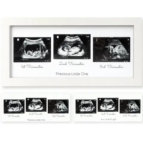 KeaBabies Wooden Picture Frame 3-Pack - Wood & Glass Baby Sonogram Frames, Gender Reveal Party Decor, First-Time Mom Gift, Wall/Shelf/Desk Desk-to-Wall Display, Newborn Nursery Decoration