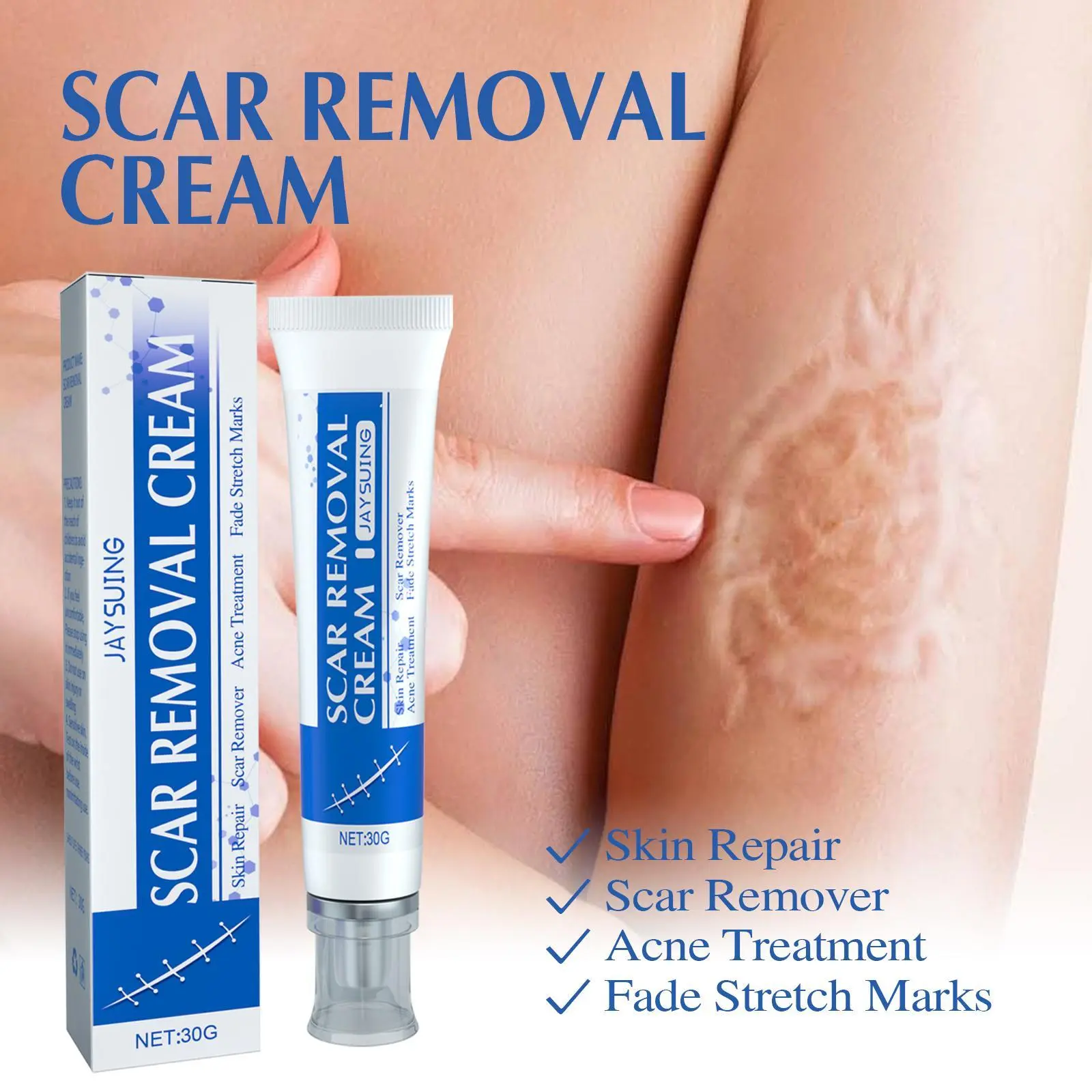 100G Odorless Scar Removal Cream - Smooth, Prop 65 Safe, Alcohol Free, All Skin Types Beauty & Personal Care Skincare Product for Adults, Maternity Healthcare Supplies