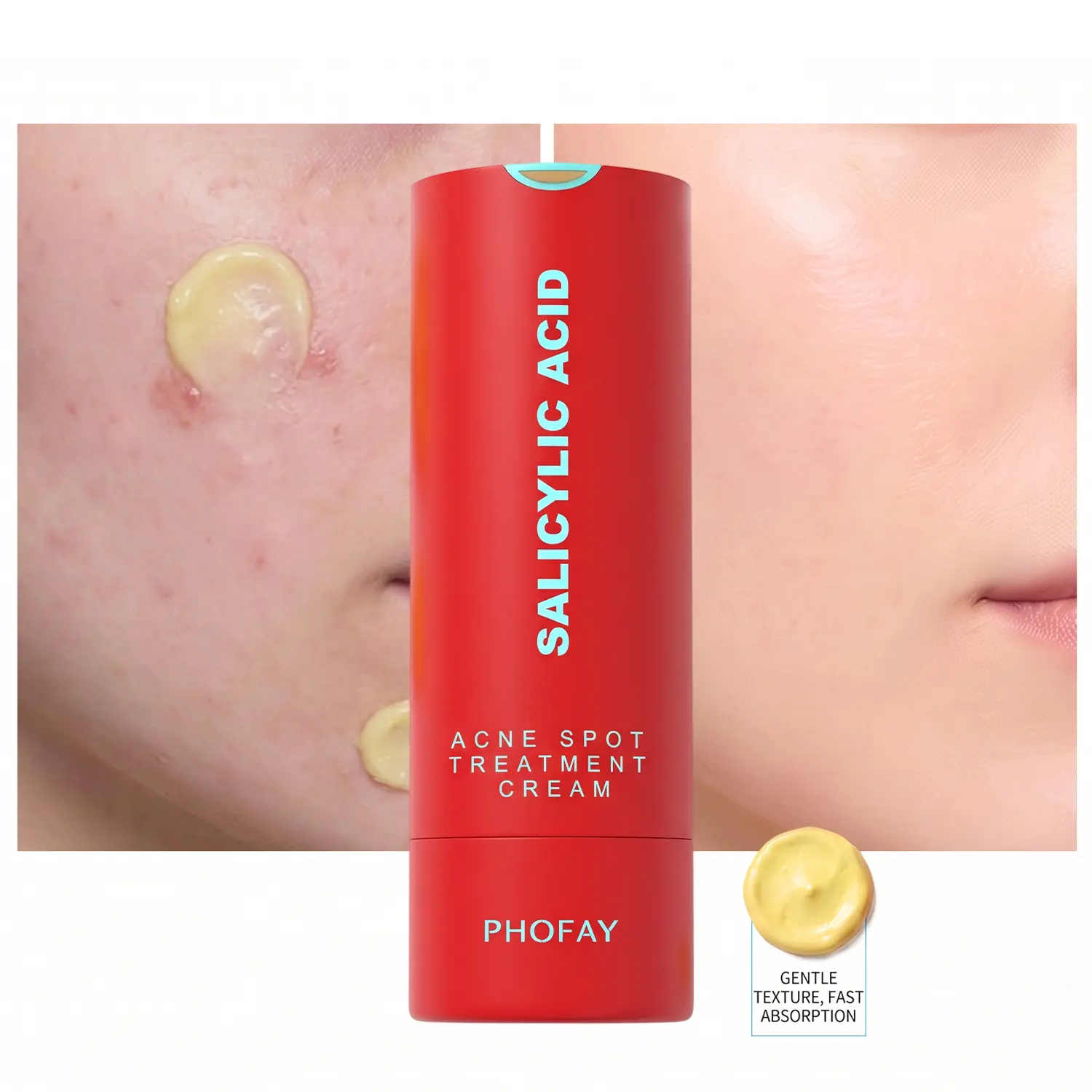Drying Lotion - Lightweight Powder Acne Spot Treatment With 1% Encapsulated Salicylic Acid, Niacinamide & Centella Asiatica Root Extract - Exfoliates Blemishes for Oily, Acne-Prone Skin, Blemish, Dark Spots, Skin Repair, Face Care Products