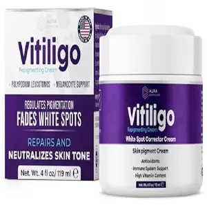 Vitiligo Cream for White Spots (4oz) - Repigmenting Cream with Polypodium Leucotomos and Melanocyte Support - Evens Skin Tone and Reduces Discoloration by Aura Dermacare