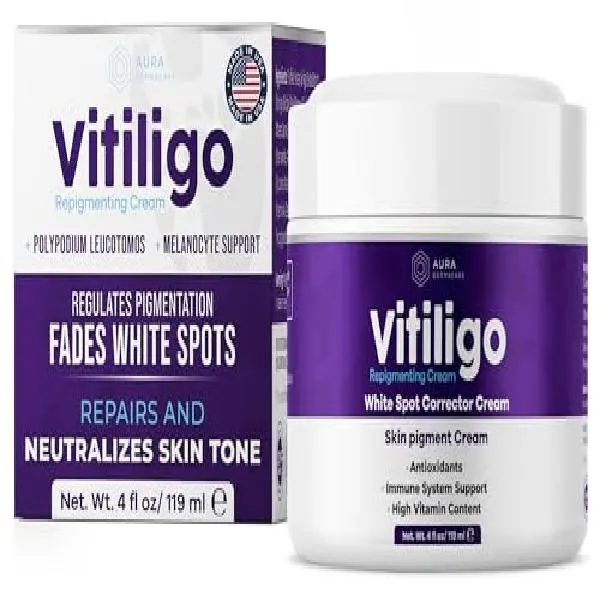 Vitiligo Cream for White Spots (4oz) - Repigmenting Cream with Polypodium Leucotomos and Melanocyte Support - Evens Skin Tone and Reduces Discoloration by Aura Dermacare