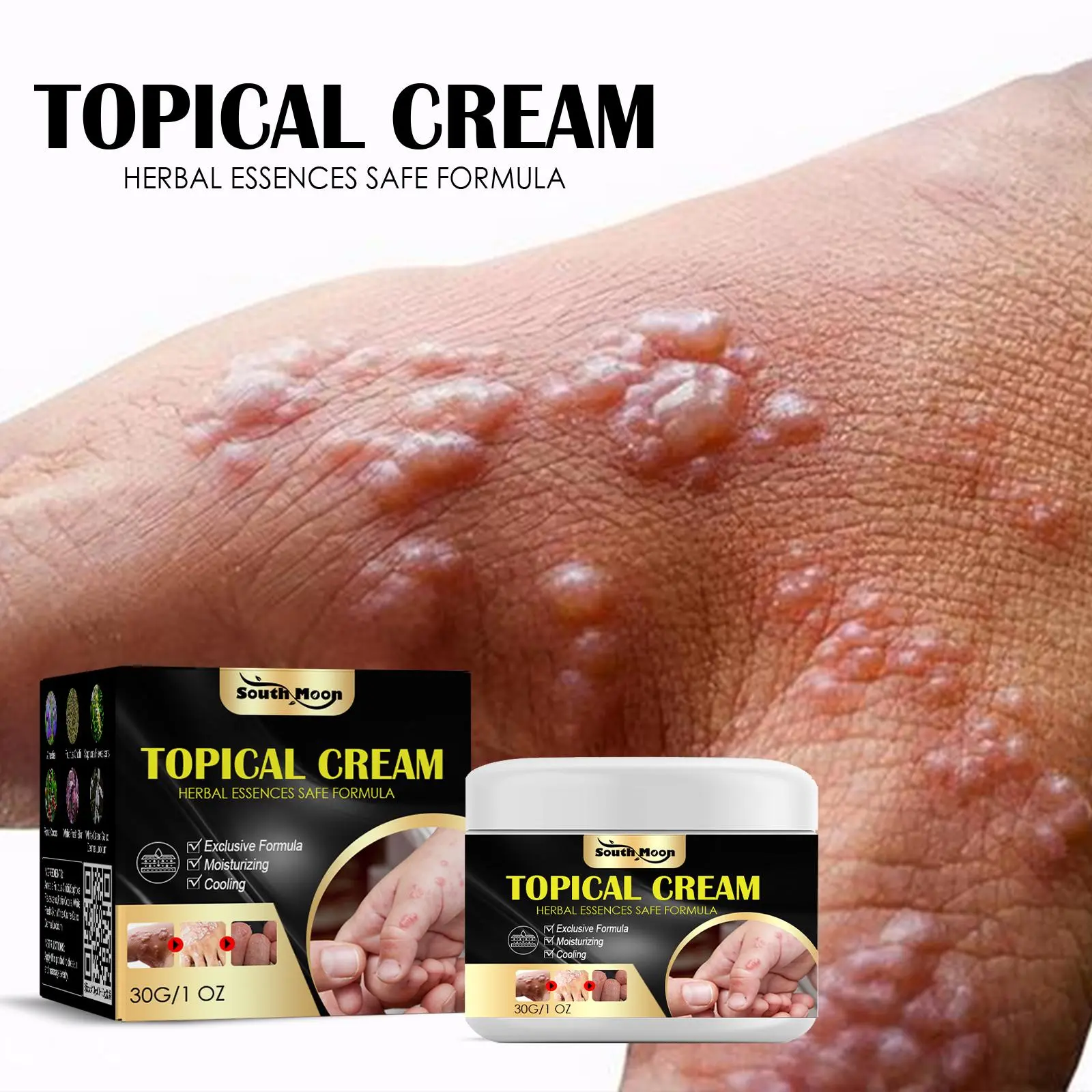 South Moon Anti-Itch Body Moisturizer Cream - Soothes Sweat-Related Itching on Hands & Ft, Dry Pruritic Skin, Relieves Mosquito/Insect Bites, Repairs Skin