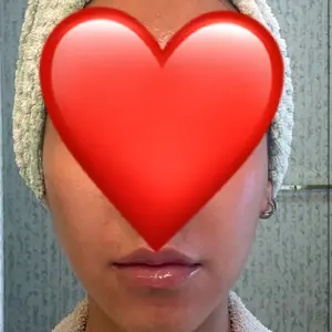 MaryRuth's Lymphatic Support Herbal Blend Liquid Drops - USDA Organic - Echinacea & Elderberry - Blue Vervain - Vegan - 30 Servings