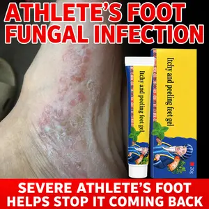 Antifungal cream for athlete’s foot that relieves itching and odor and helps with peeling skin; improves blisters and thickened skin; deeply kills foot fungus and repairs damaged skin; provides long-lasting odor control and itch relief; addresses recurren