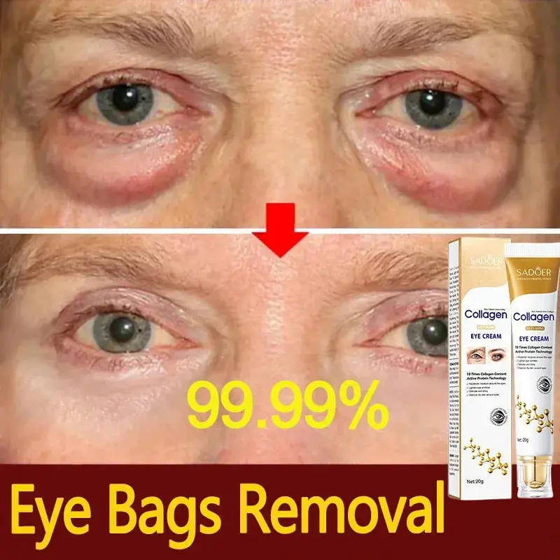 Collagen Eye Cream, Instant Eye Bag Removal Moisturizer with Smooth, Hydrating, Repairing Effects to Fight Dark Circles, Puffiness, Wrinkles, Fine Lines and Brighten Skin, Collagen Repair, Beauty Products, Bag Reduction Eye Treatments