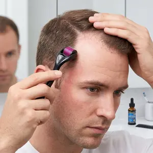 0.5mm Titanium Scalp Roller | 540 Needle Microneedling Tool for Head Care, Scalp Massage & Hair Care Routine