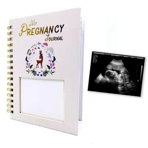 82 Page Pregnancy Diary Book, Memory Notebook, Record Book, Gift for New Moms, Ultrasound Scan Photos, Important Stage Tracking