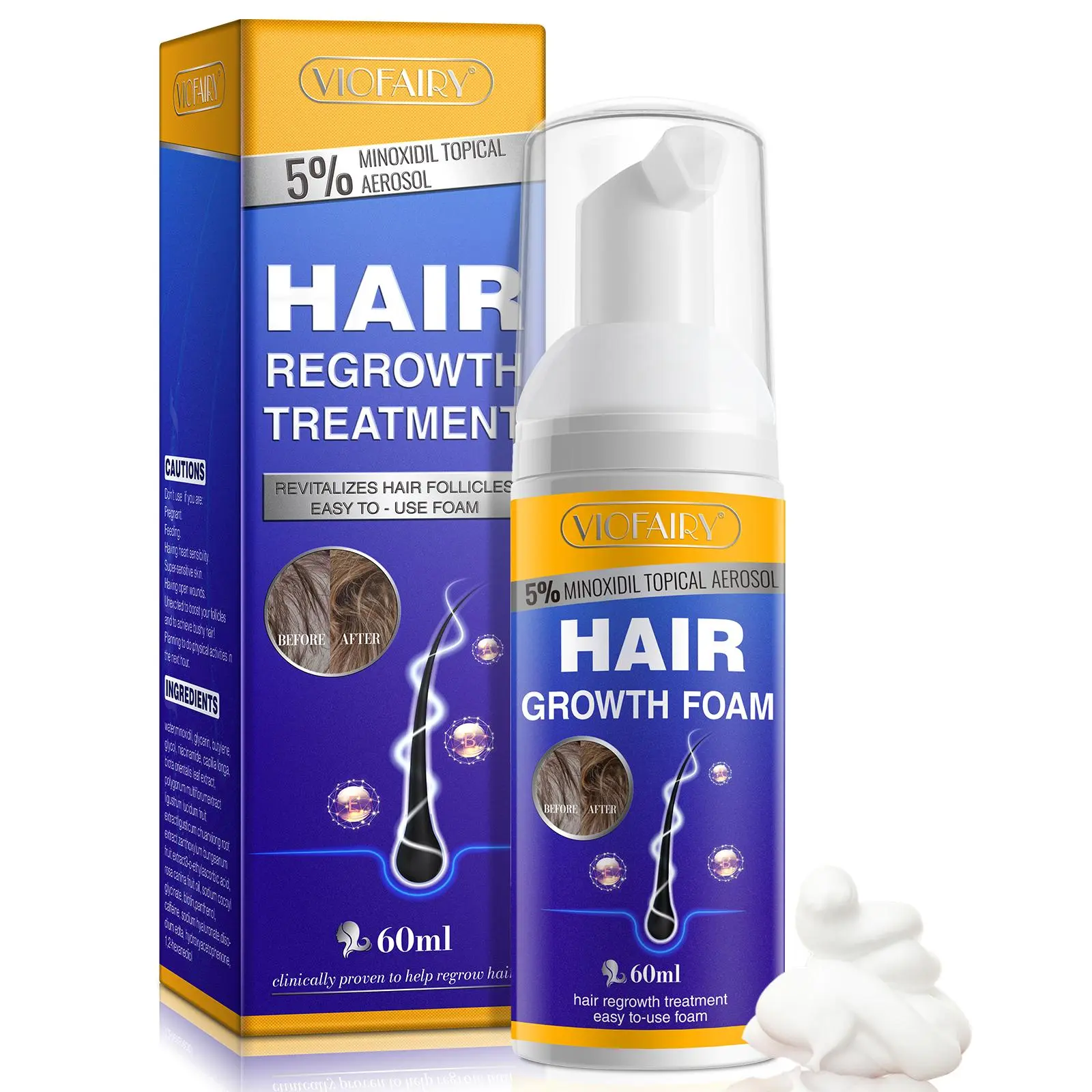 1 box of 60ml VIOFAIRY Minoxidil Solution for hair care, Hair Growth Product, Haircare, suitable for people with sparse hair, Healthier Hair