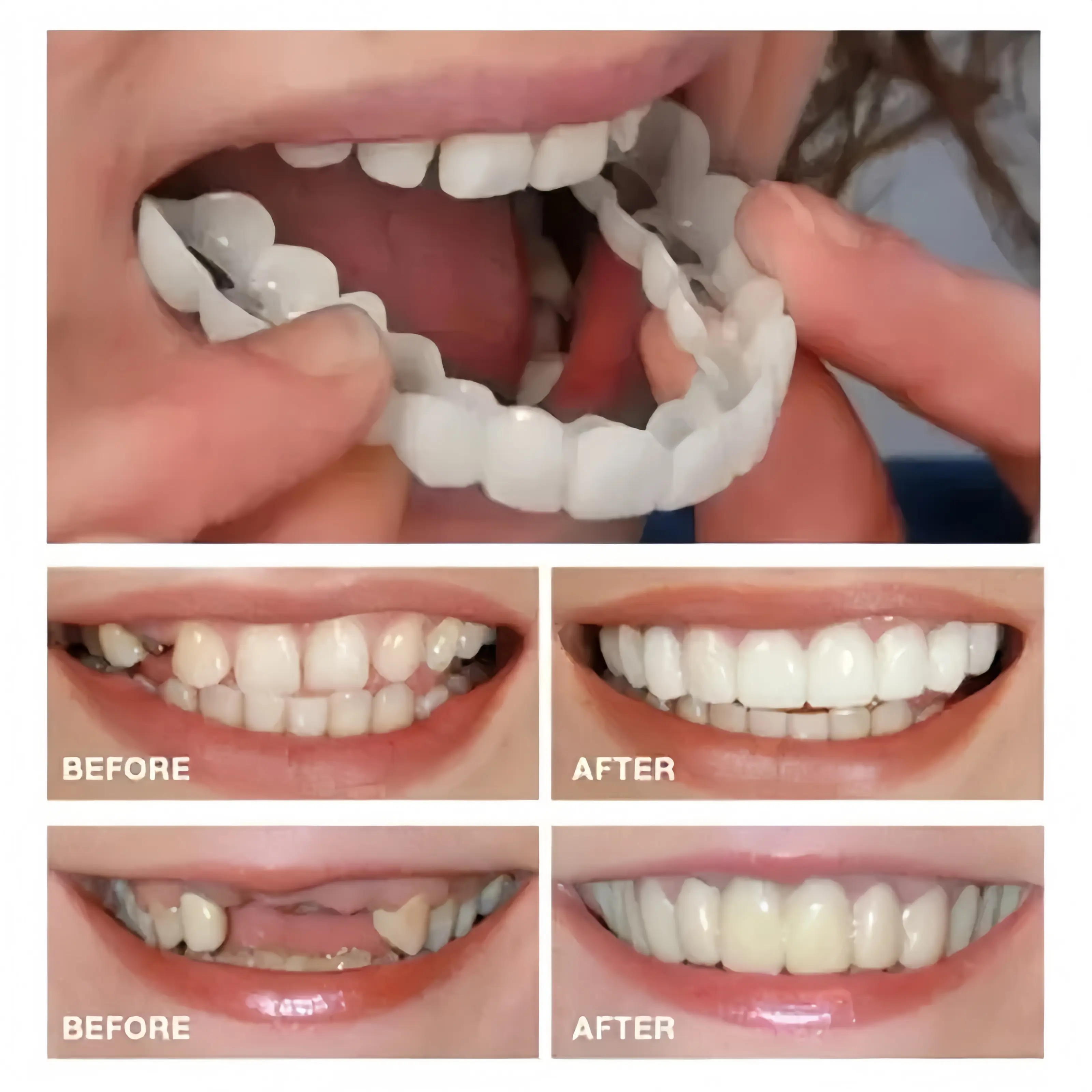 Temporary Teeth Whitening Veneers, Comfortable Upper & Lower False Teeth Covers for an Instant Bright Smile and Photo Use, Fake Teeth, Cosmetic Teeth