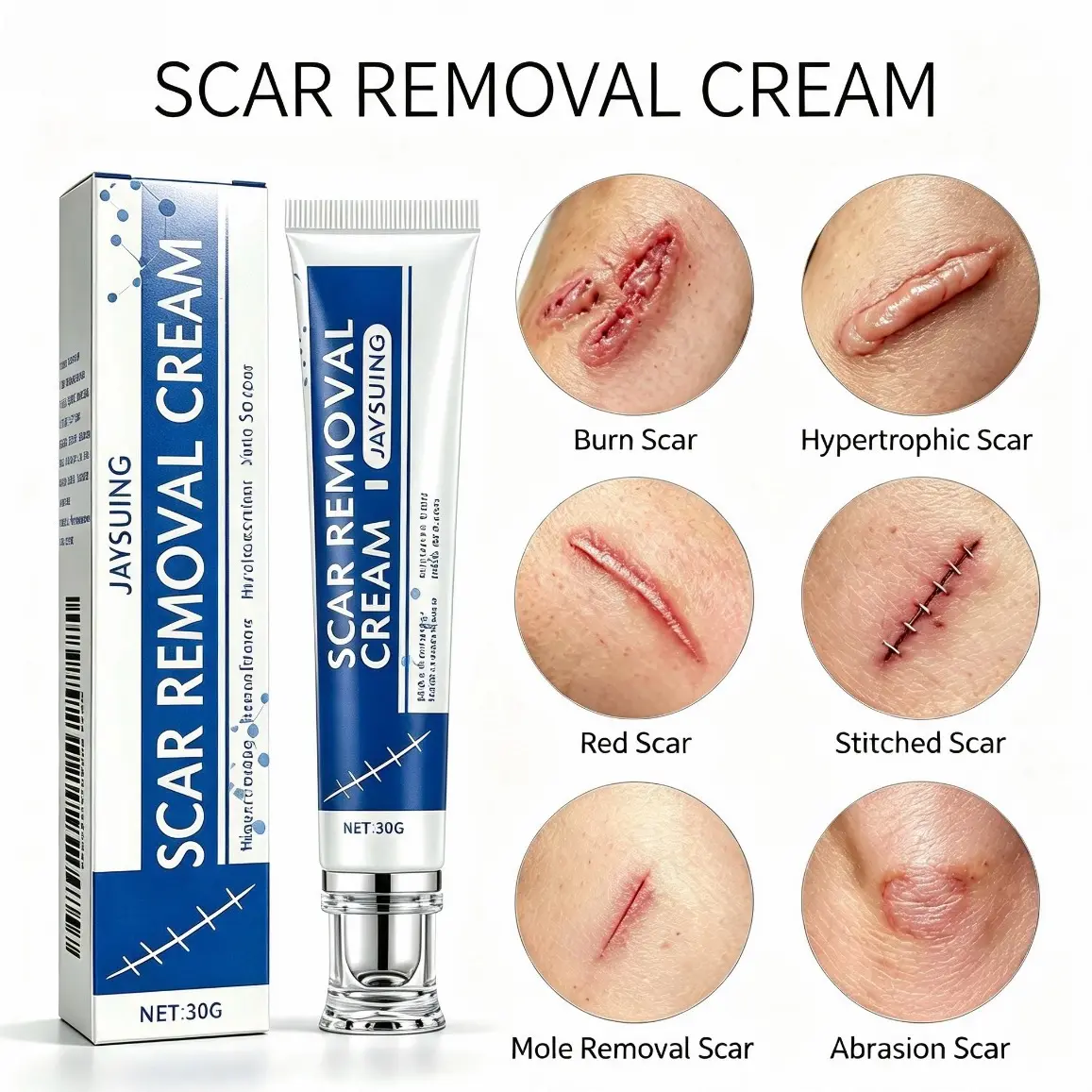 Scar Removal Cream, Effective for Burn Scars, Hypertrophic Scars, Red Scars, Stitched Scars, Mole Removal & Abrasion Scars, Skin Repair Treatment for Old & New Scars, Gentle Scar Care Cream Body care kit