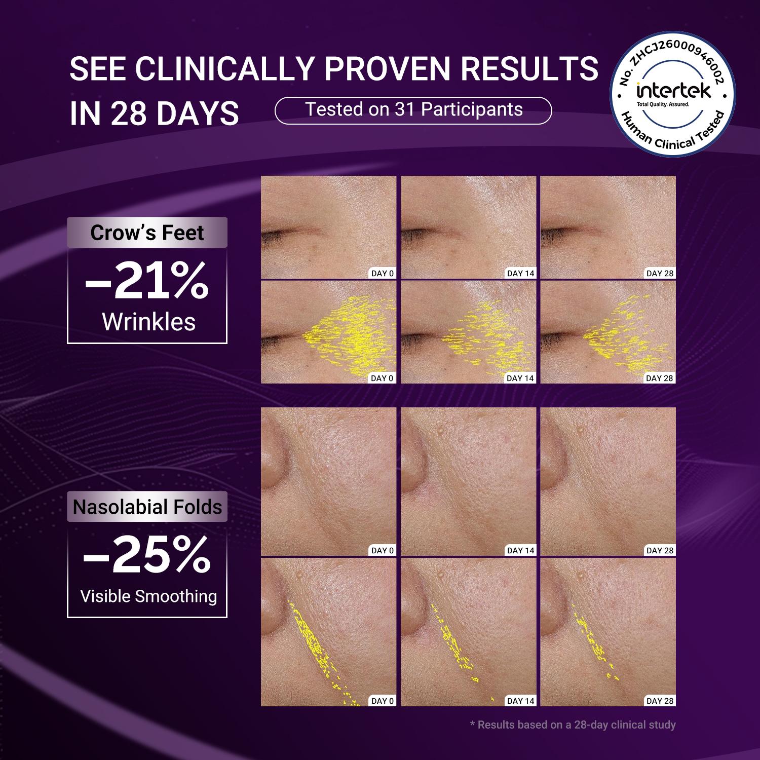 Dr.Leo PDRN EYE CARE SET Dual-Resource 10% PDRN Eye Treatment Bundle | Instant Rescue Eye Patches + Sustained Anti-Aging Eye Cream for Wrinkles, Puffiness & Dark Circles