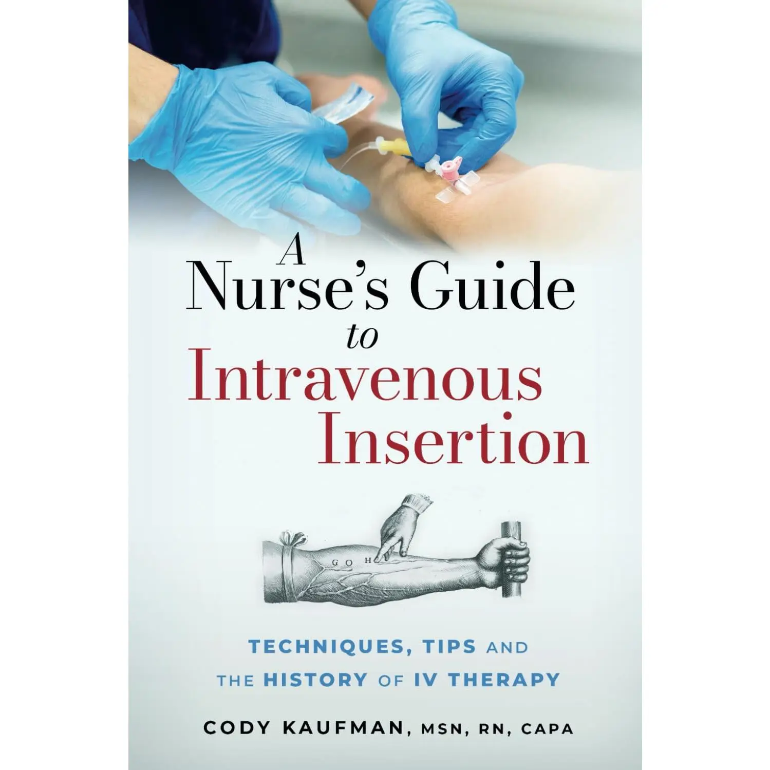 A Nurse's Guide to Intravenous Insertion: Techniques, Tips, and the History of IV Therapy