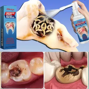 Special analgesic spray for toothache, used to reduce swelling and pain of teeth, eliminate inflammation of wisdom teeth, gingivitis, nerve treatment of periodontitis.