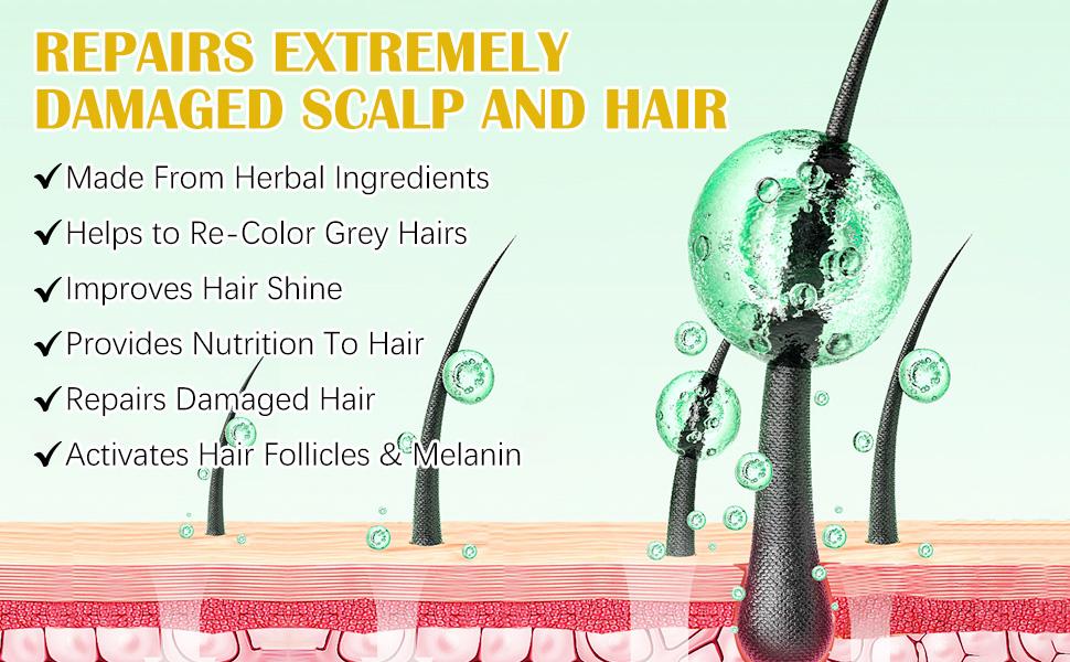 Beard care/hair care with Roller 0.25mm Scalp Kit,Scalp Treatments,Serum With Biotin, Microneedle Beard Roller for Thicker Longer Fuller Hair and Beard ,Gifts for Men Dad,Birthday gift,Daily hair care/Hair Care and Styling
