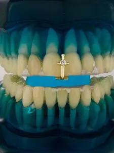 1pc Top Grillz, 14k Copper, Hip Hop Zirconium Design, Full Diamond Grillz, Unisex Rap Fashion Dental Jewelry