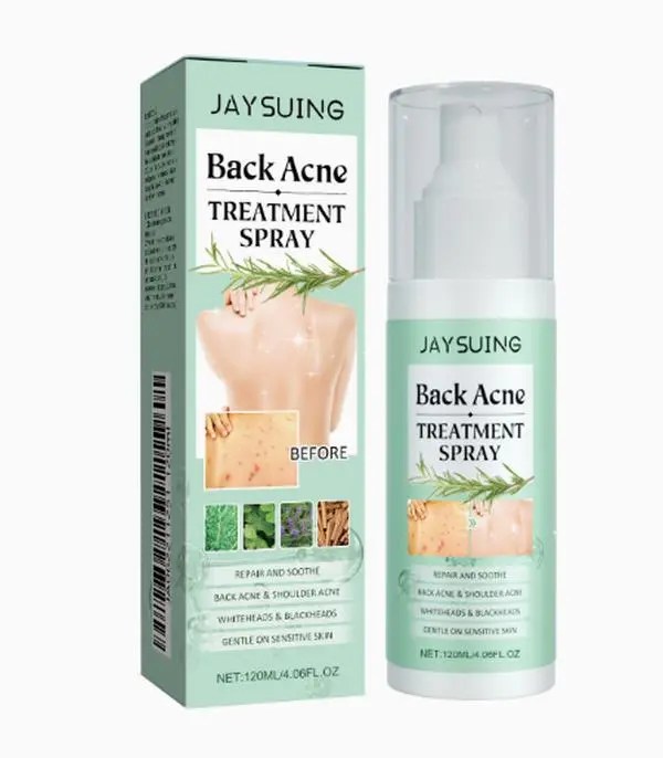 Back and Shoulder Acne Treatment Spray with Tea Tree Oil, Gentle Skin Repair for Sensitive, Acne-Prone Skin, Lightweight Formula, 120ml, Salicylic Acid, Spray Bottle, Witch Hazel, Clears Blemish, Body Areas, Anti-Acne