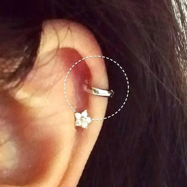 Simple Cartilage Hoop