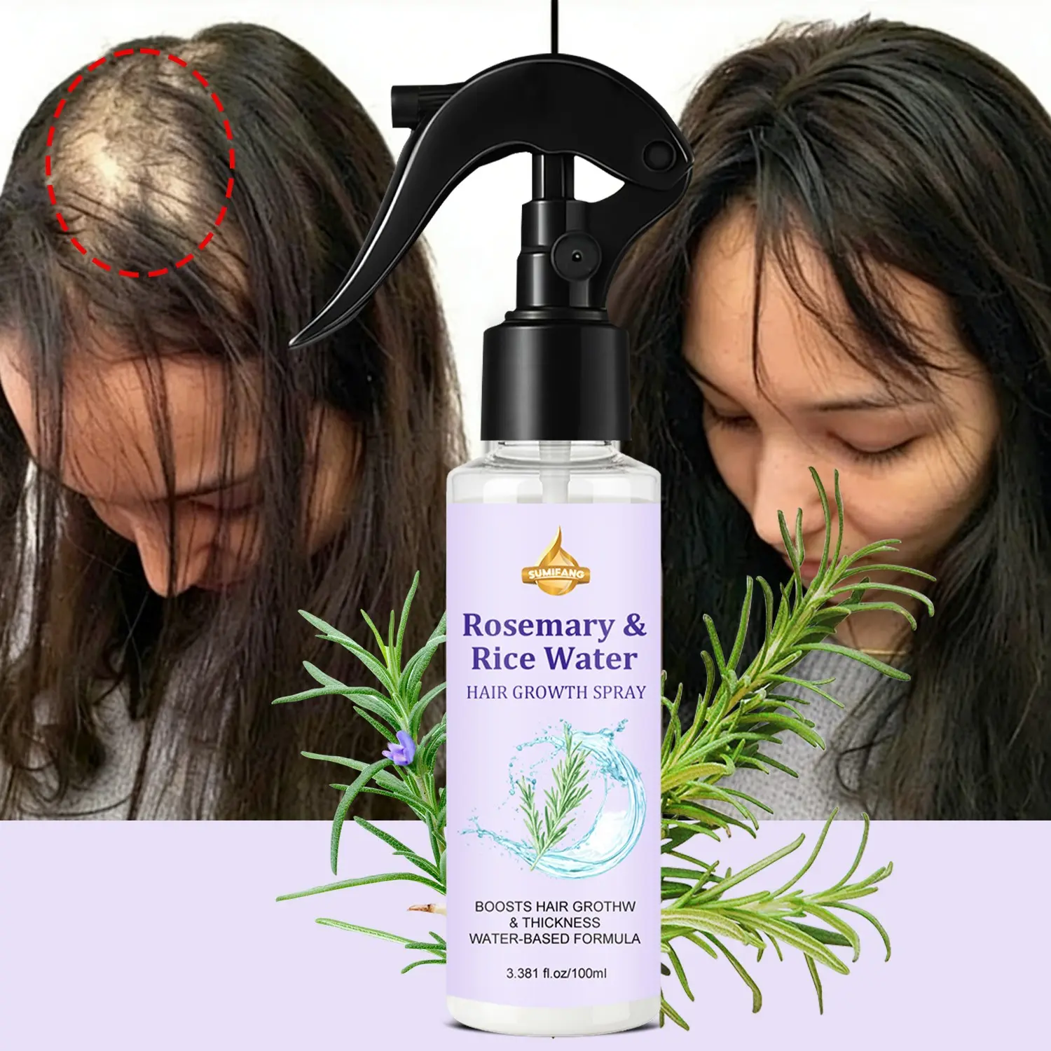 SUMIEANG Rosemary & Rice Water Scalp Growth Spray, Hair Growth Stimulator, Hair Growth Serum (100ml), Rosemary + Rice Water + Collagen Peptides, Stimulates Follicles to Boost Volume, Water-Based Formula, Refreshing, Non-Greasy, Strengthens Strands