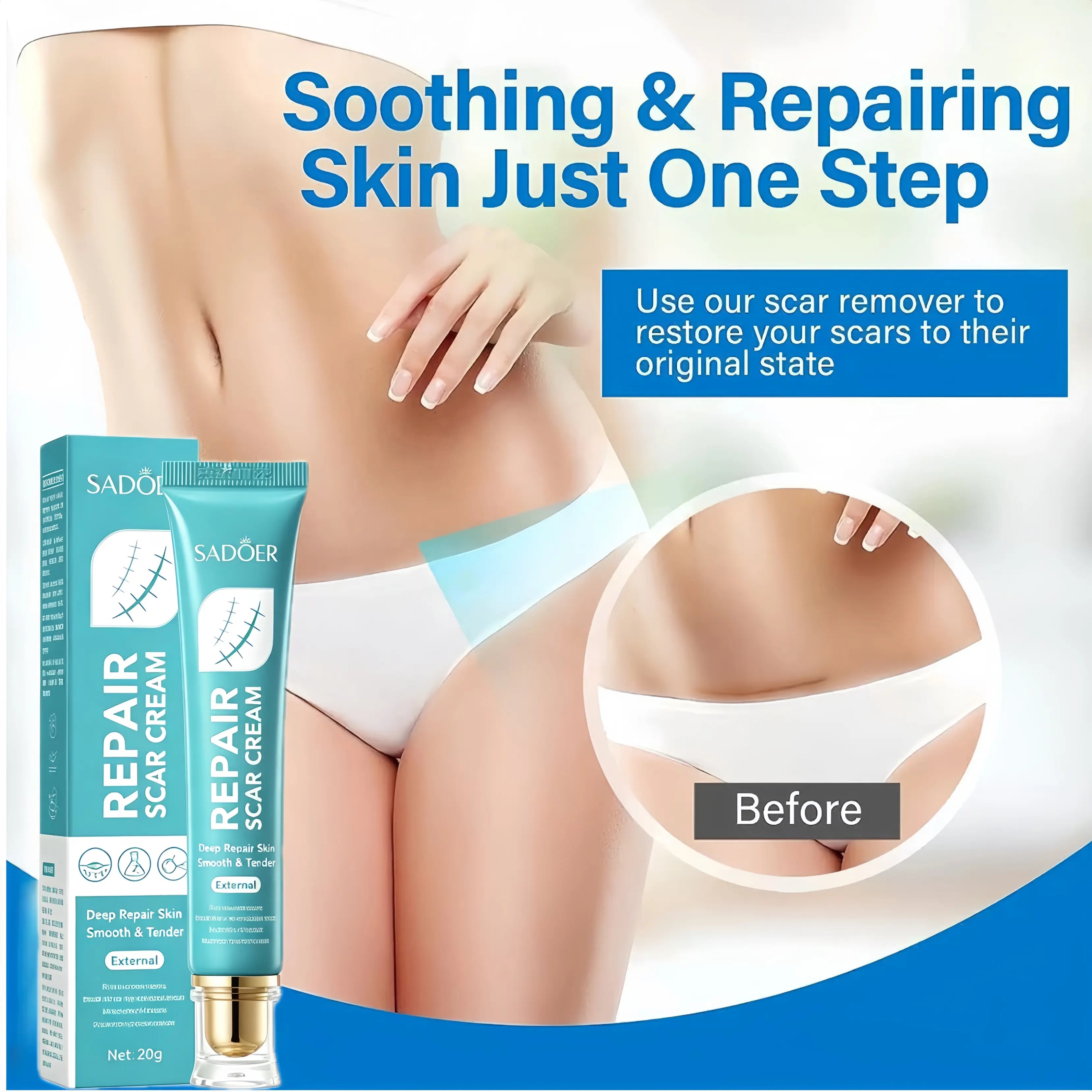 Advanced Silicone Scar Cream -Improves Appearance of Scars, Smooths &Hydrates Skin, Gentle Formula for Old & NewScars 20g Body scar care cream